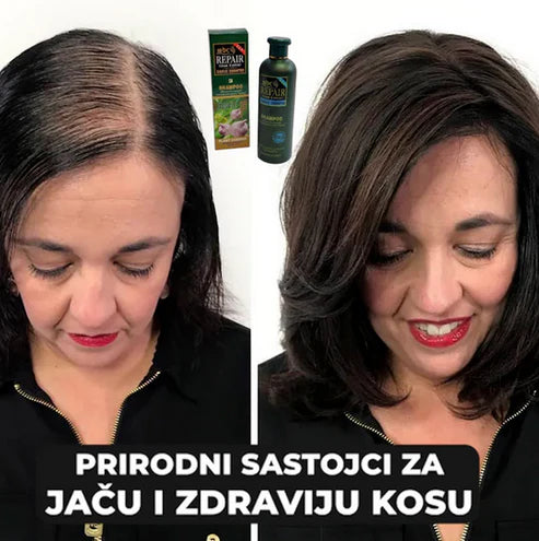 Šampon sa ekstraktom BIJELOG LUKA - Protiv OPADANJA i za brži RAST KOSE